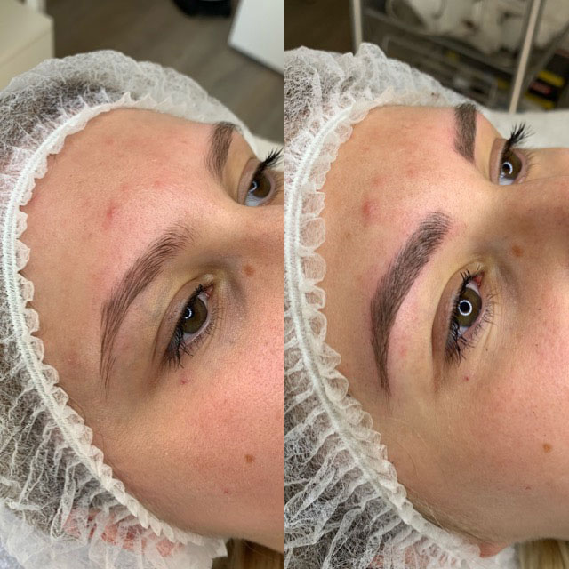 Microblading In Dortmund Truemetics Dein Kosmetikstudio In Dortmund