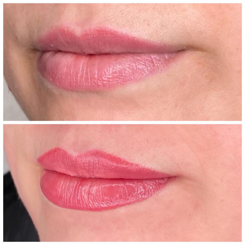 lippenpigmentierung