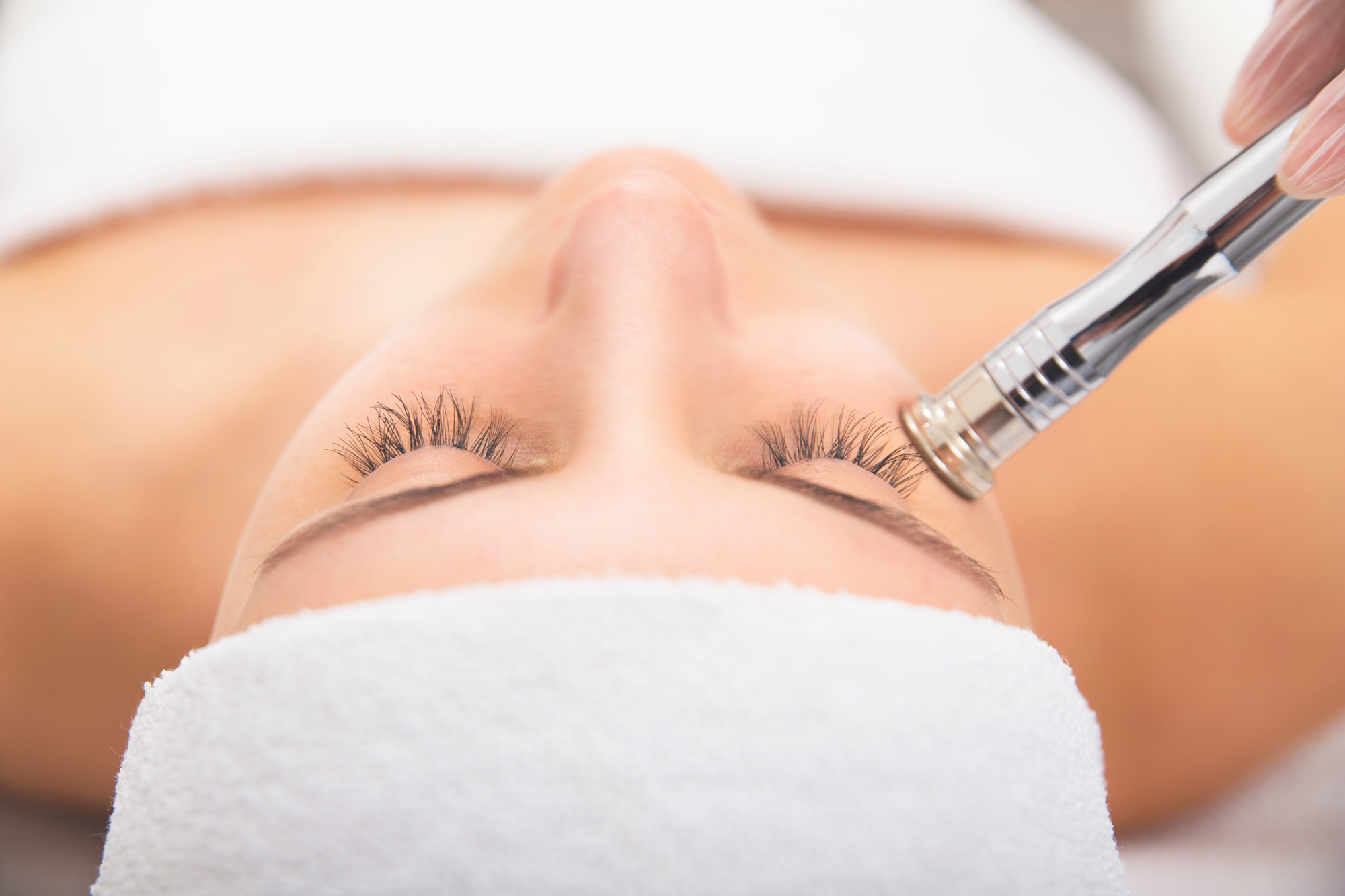 Microdermabrasion treatment